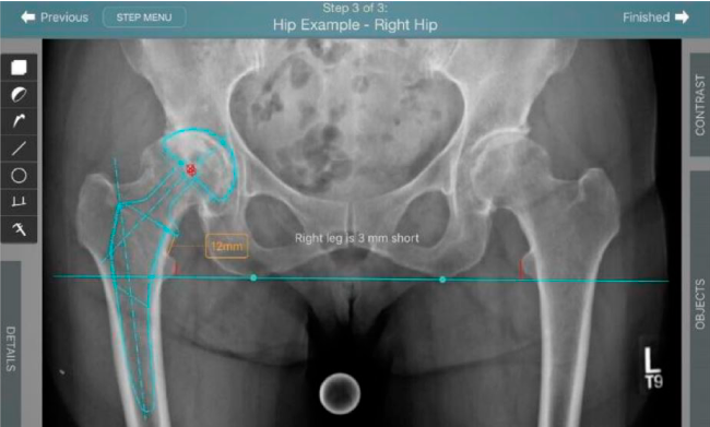 Demostraci�n Velys